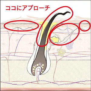 ココにアプローチ