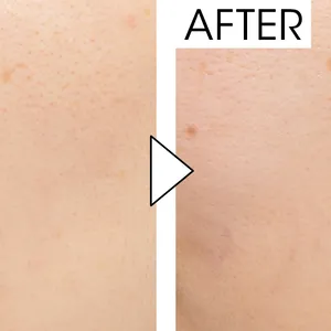 マキア　毛穴ケア　おすすめ ジバンシイ　ソワン ノワール UV コンパクト