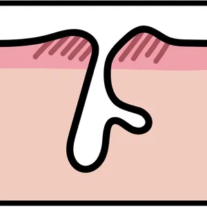 【悩み別】毛穴を目立たなくする方法 PhotoGallery_1_8