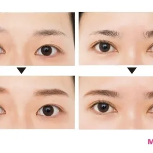 眉山の毛がない、薄眉さんの悩みを解決！ 使うべきアイテムも教えます