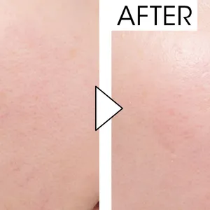 マキア　毛穴ケア　おすすめ　スック　ザ プライマー