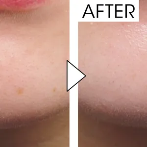 マキア　毛穴ケア　おすすめ　ラ ロッシュ ポゼ　UVイデア XL プロテクショントーンアップ ローズ+