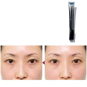 ほうれい線をどうにかしたい！ あなたのほうれい線、どっち？_1_18