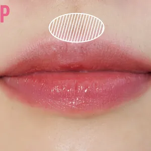 LIP