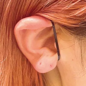 耳ツボ美容の効果は？ ツボの位置を解説 PhotoGallery_1_8