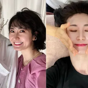 美容課金 小顔矯正