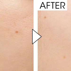 マキア　毛穴ケア　おすすめ　クレ・ド・ポー　ヴォワールルミヌ