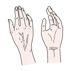 手のエイジング乾燥ふしくれ血管浮き