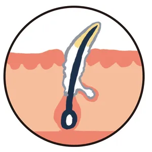 硬め白つまり毛穴イメージ