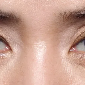 黒ぐま×たるみぐまタイプのくまカバー＆涙袋メイクのテクニック アフター