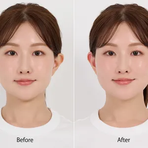 セルフケアで小顔になろう！