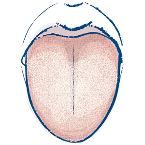 目指せ、日々快調！湿気とのつき合い方 PhotoGallery_1_20