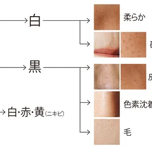 あなたのつまり毛穴はどれ？