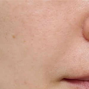 【悩み別】毛穴を目立たなくする方法 PhotoGallery_1_35