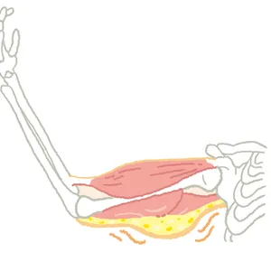 筋肉・脂肪・皮膚のトリプルたるみ発生