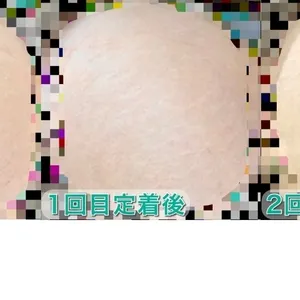 肉割れ、アートメイク