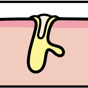 【悩み別】毛穴を目立たなくする方法 PhotoGallery_1_3