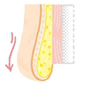 弾力を失った肌は重力でみるみる垂れ下がる