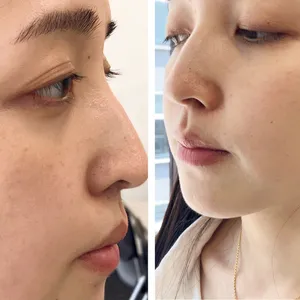 マキア　毛穴ケア　乾燥肌