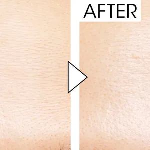 マキア　毛穴ケア　おすすめ　SHISEIDO　エッセンス スキングロウ プライマー