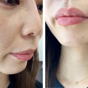 マキア　毛穴　皮脂　スキンケア　肌の状態　4