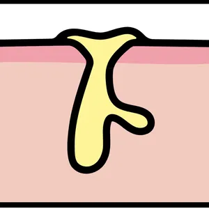 【悩み別】毛穴を目立たなくする方法 PhotoGallery_1_23