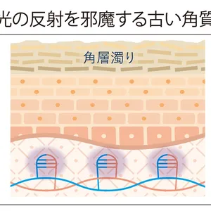 光の反射を邪魔する古い角質