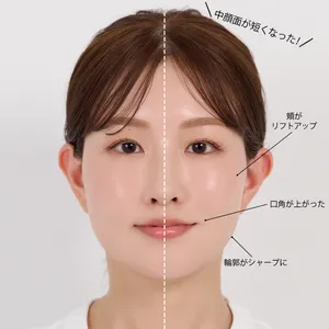 片側だけでもこんなに変わる！