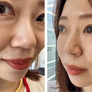 マキア　毛穴ケア　おすすめ　化粧品　たるみ毛穴　混合肌