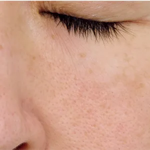 【悩み別】毛穴を目立たなくする方法 PhotoGallery_1_29