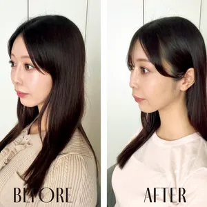 最新おすすめヘアガジェット MYTREX HEAD SPA DEEP Xをお試しレビュー