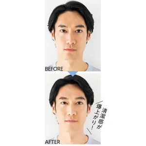 BEFORE→AFTER 1