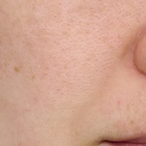 【悩み別】毛穴を目立たなくする方法 PhotoGallery_1_36