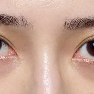 紫ぐまタイプのくまカバー＆涙袋メイクのテクニック ビフォー