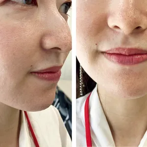 マキア　毛穴　皮脂　スキンケア　肌の状態