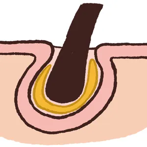 【最新】毛穴、角質ケアの最前線 PhotoGallery_1_13