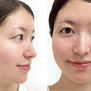 マキア　毛穴　皮脂　スキンケア　肌の状態　3