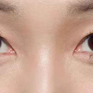 紫ぐま×たるみぐまタイプのくまカバー＆涙袋メイクのテクニック アフター