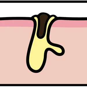 【悩み別】毛穴を目立たなくする方法 PhotoGallery_1_19